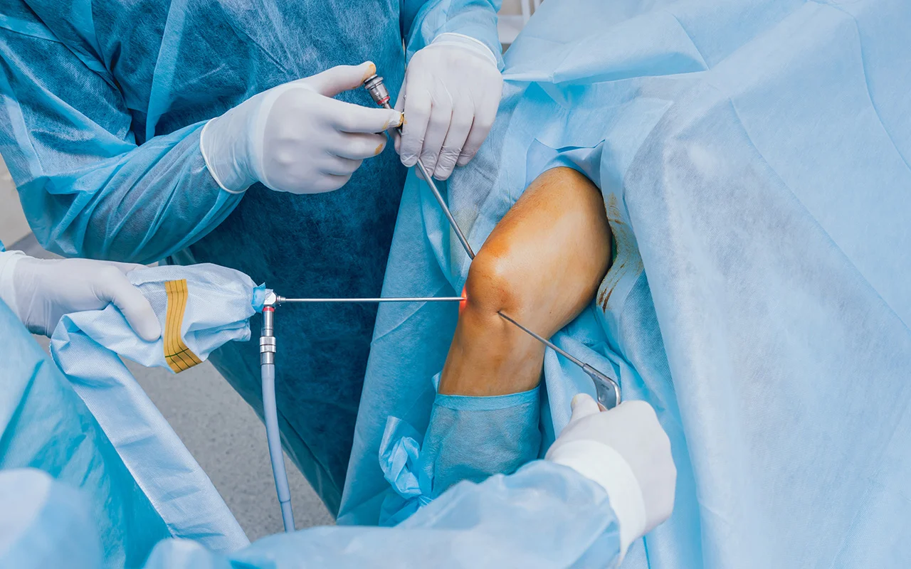 Knee Arthroscopy In Guntur